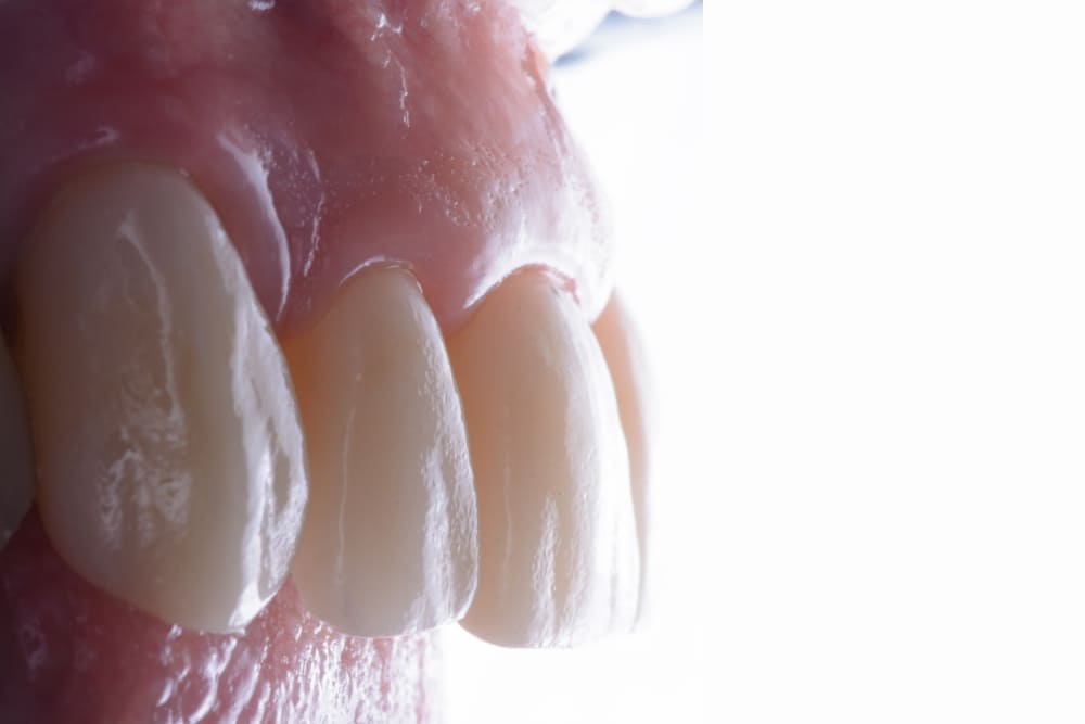 Dottori Mandelli | Faccette dentali 10